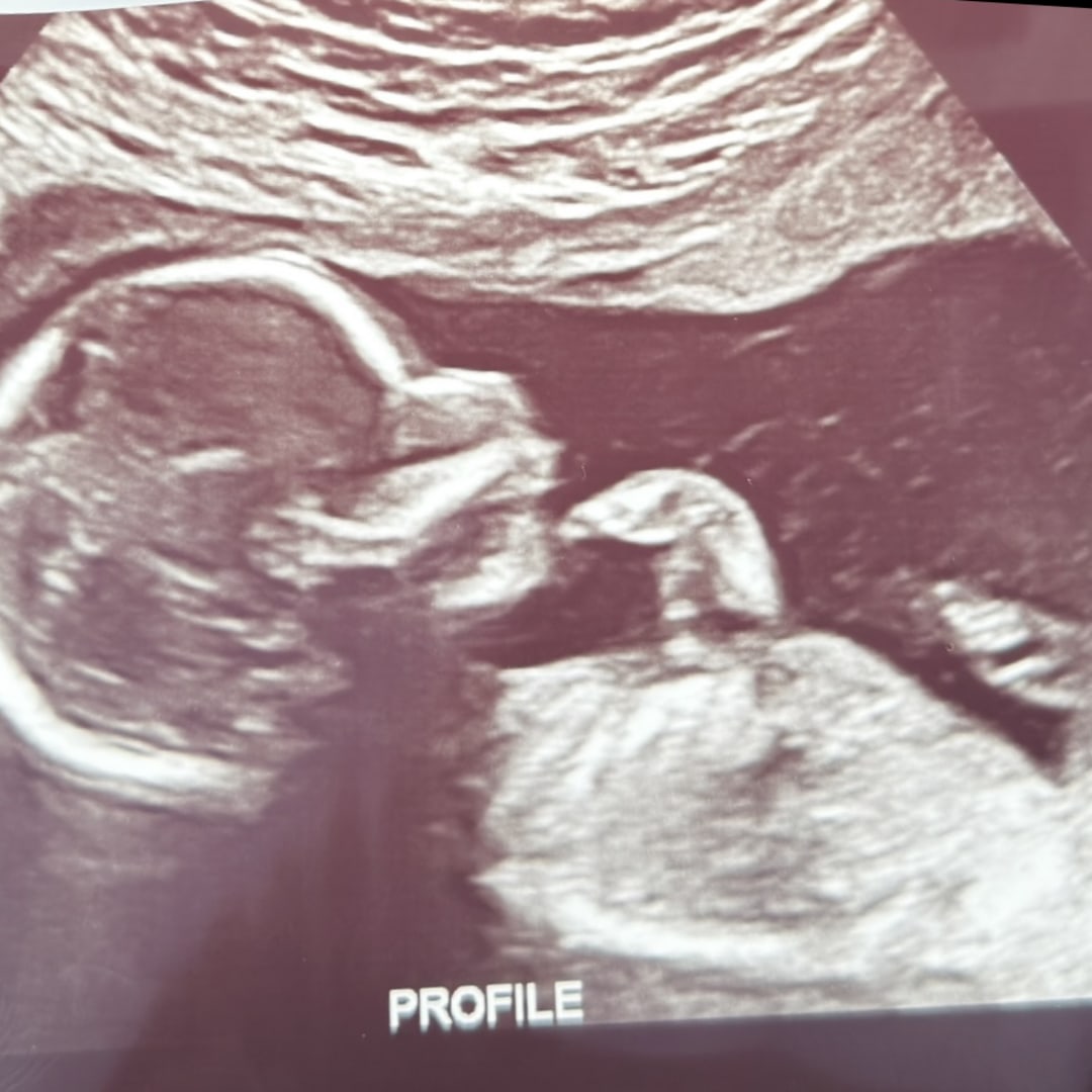 Photo shared by Giovana for their Babylist baby registry.