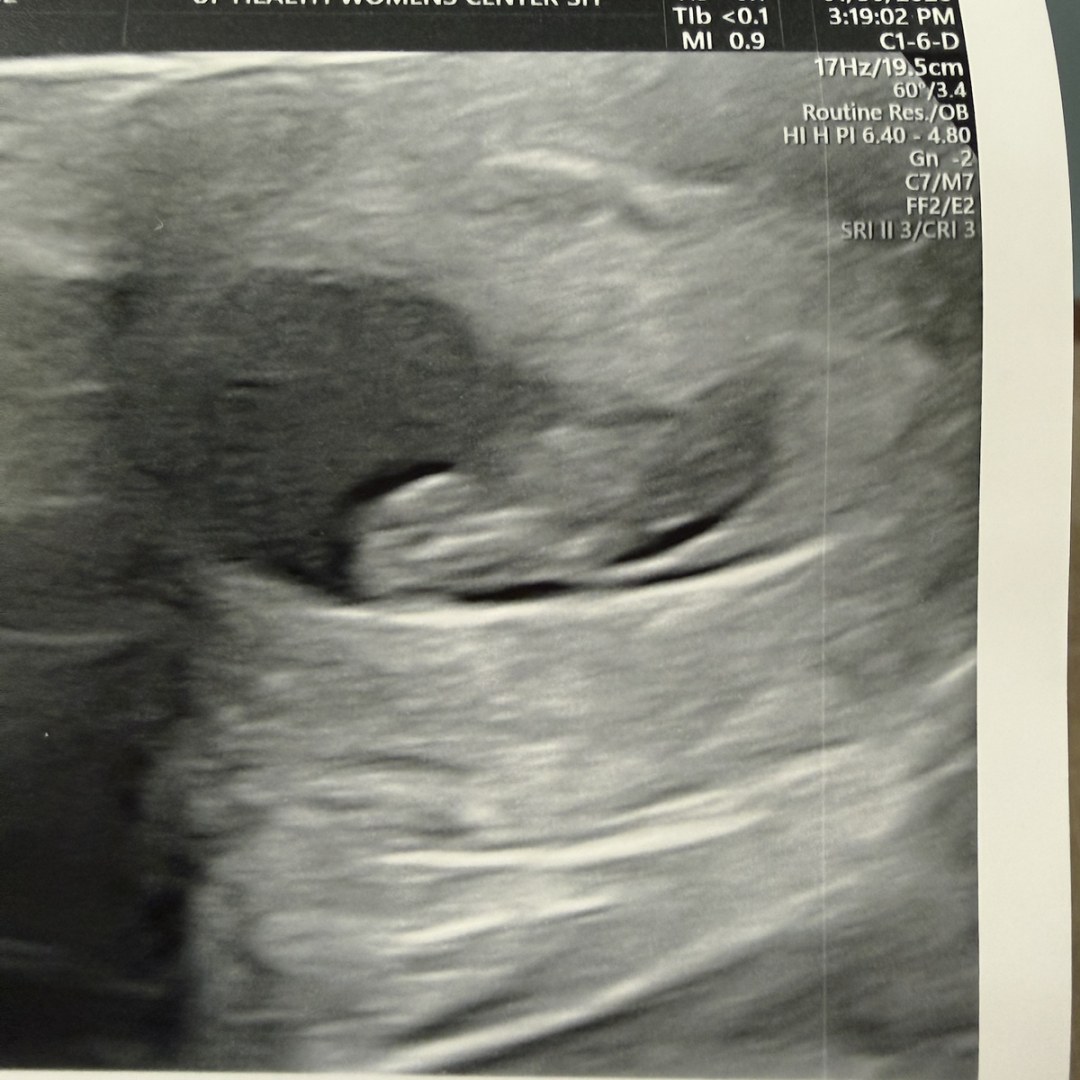 Photo shared by Willow for their Babylist baby registry.