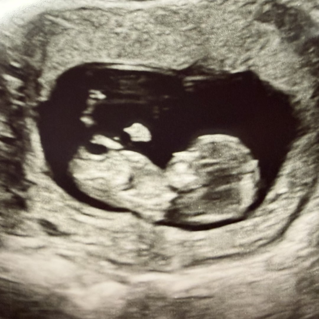 Photo shared by Jayde for their Babylist baby registry.