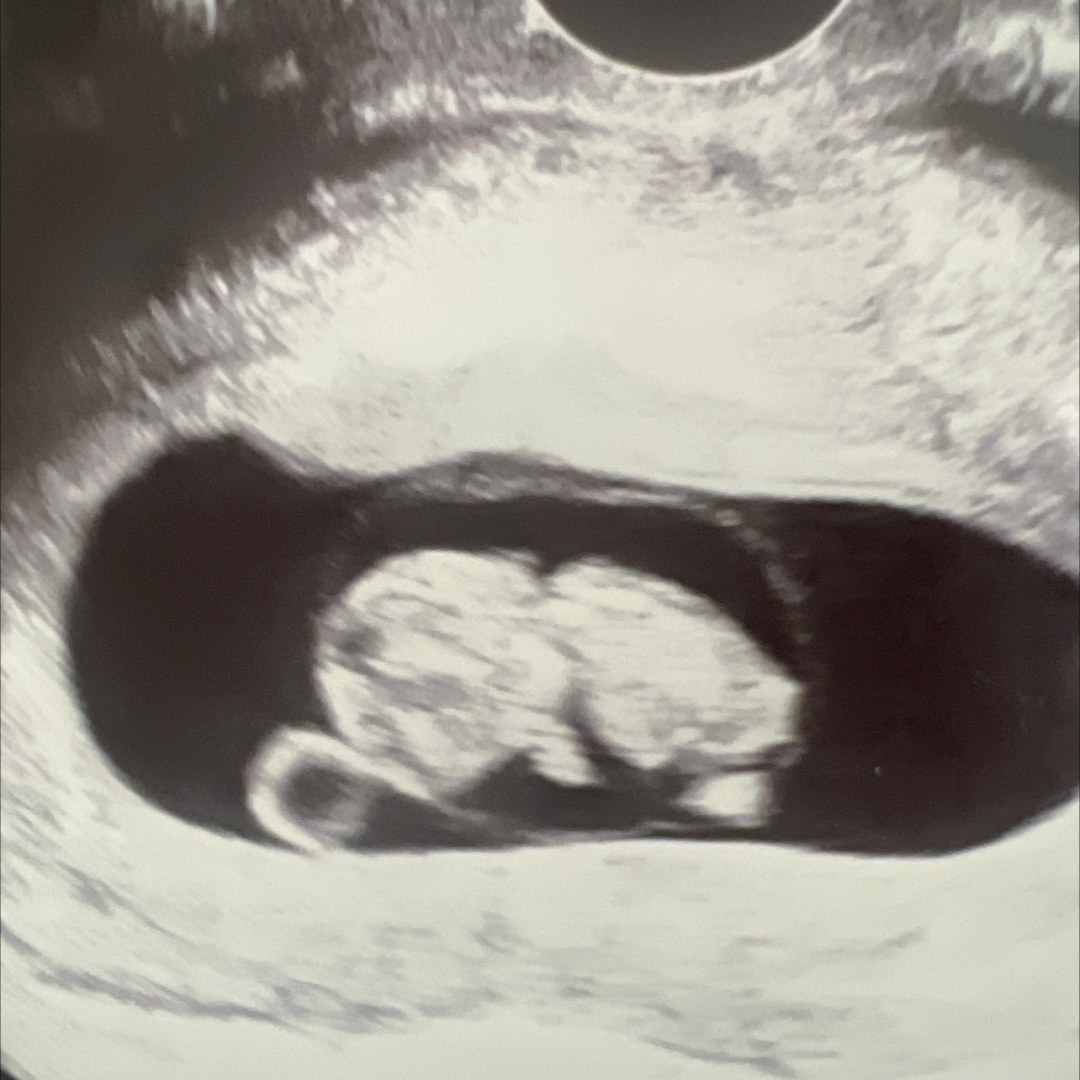 Photo shared by Barbara for their Babylist baby registry.