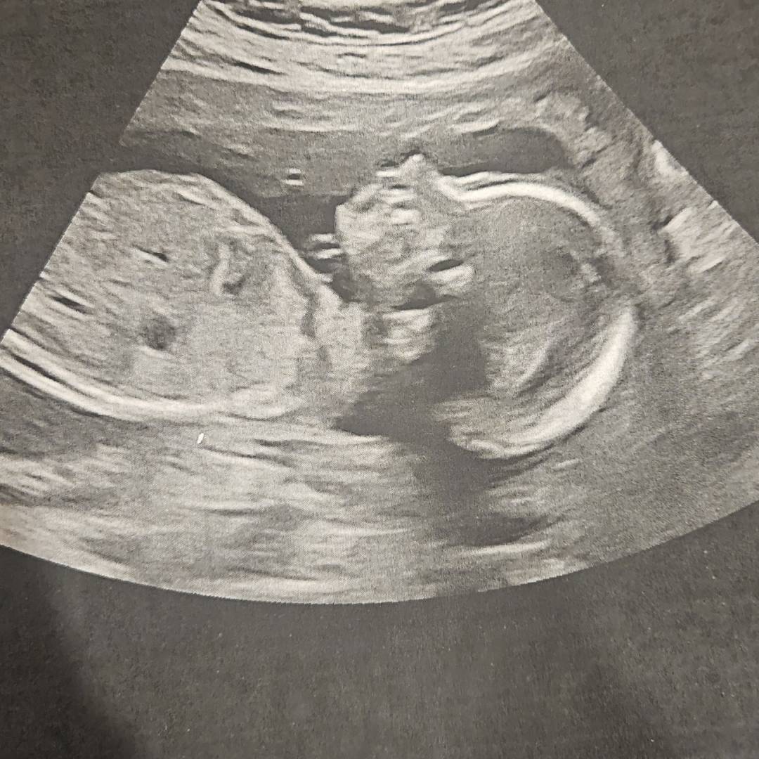 Photo shared by Amanda for their Babylist baby registry.