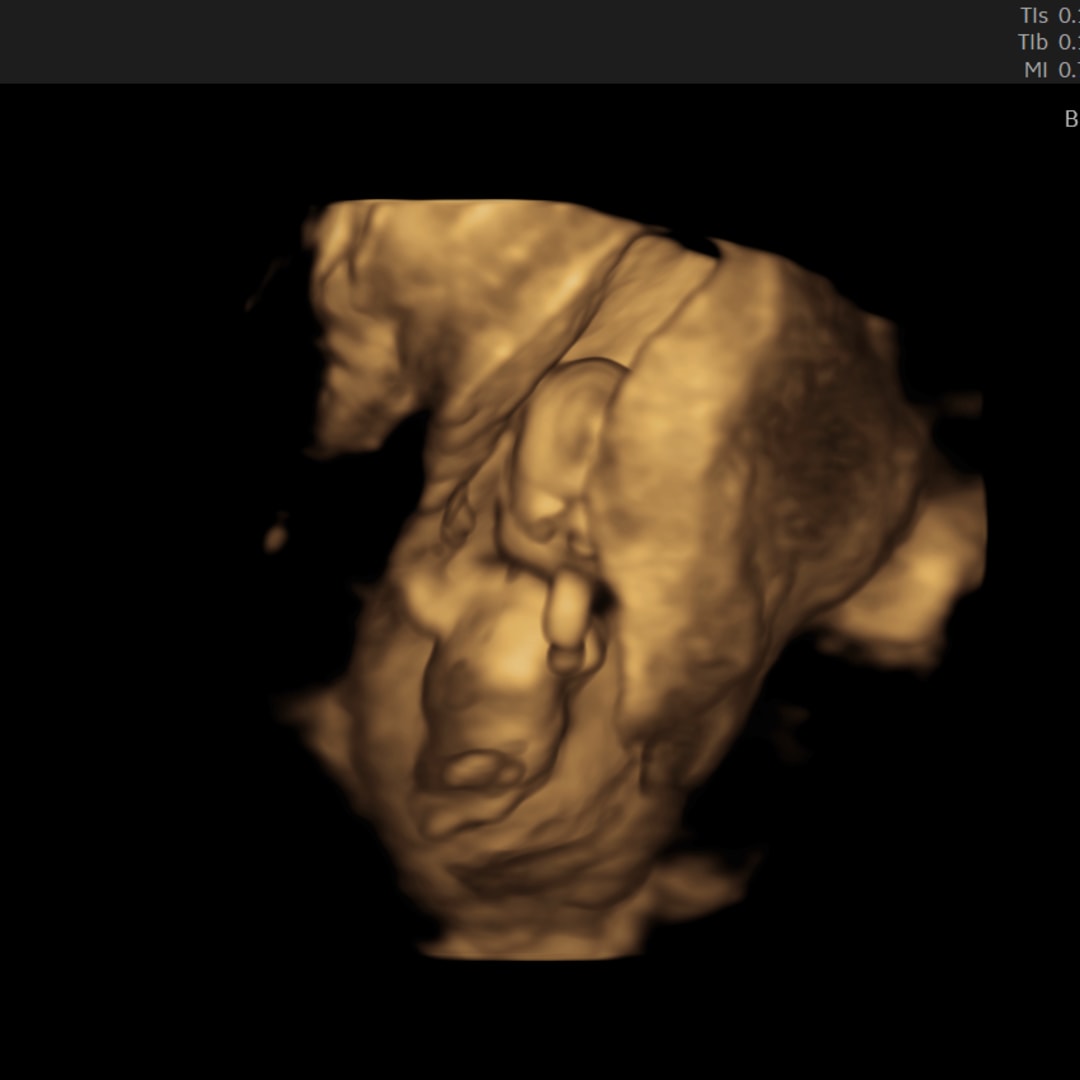 Photo shared by Jordyn for their Babylist baby registry.