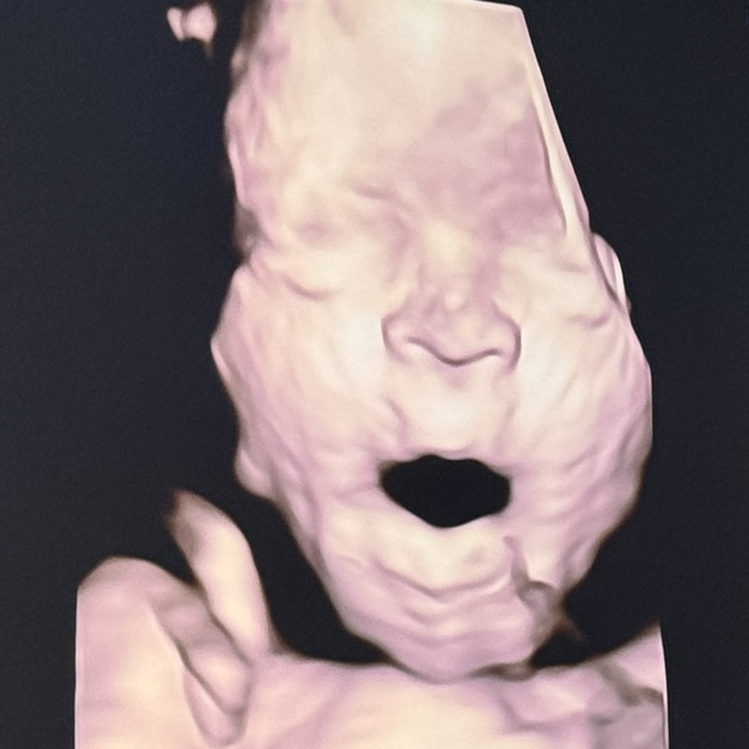 Photo shared by Maggie for their Babylist baby registry.