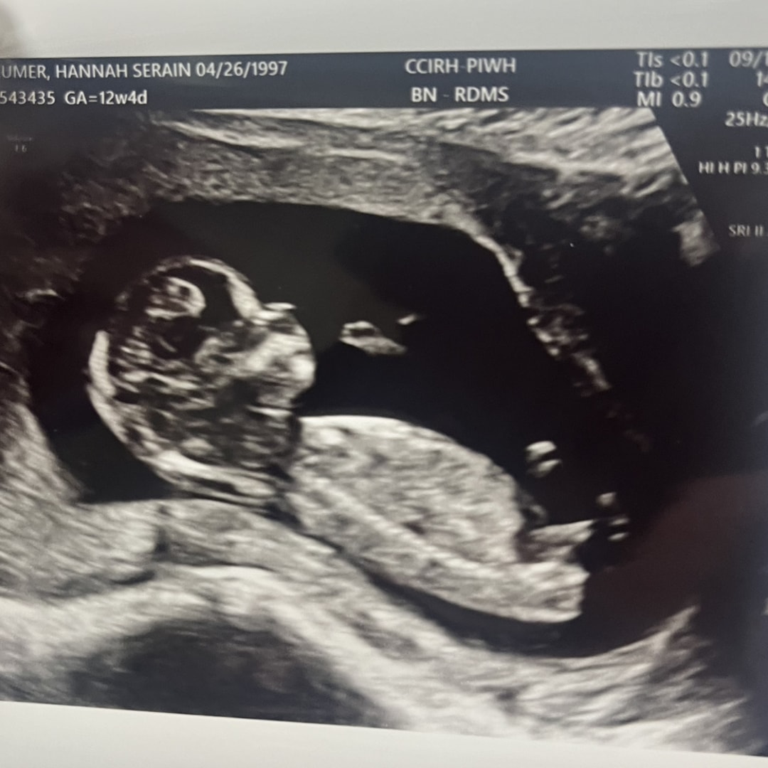 Photo shared by Hannah for their Babylist baby registry.