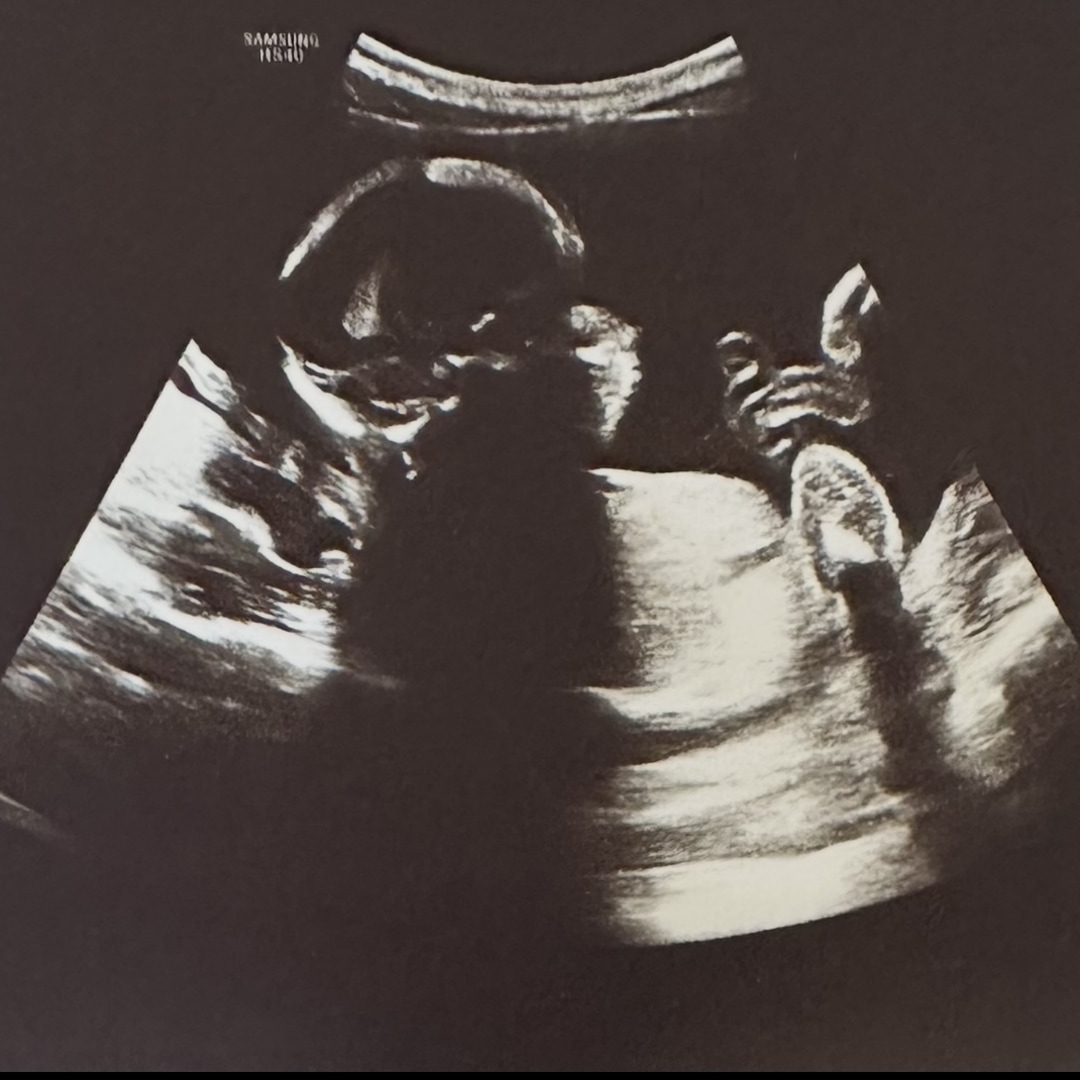 Photo shared by Cierra for their Babylist baby registry.