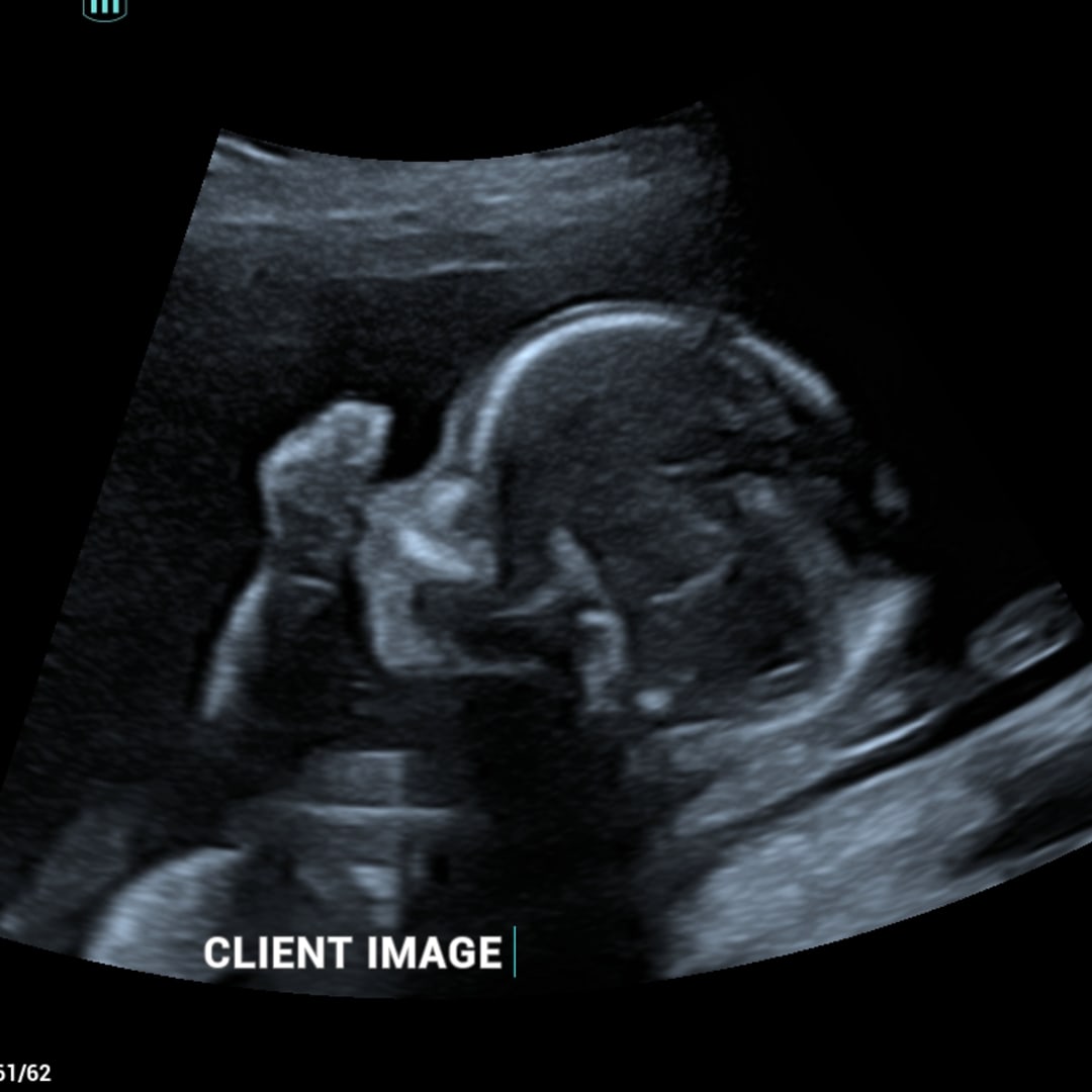 Photo shared by Starla for their Babylist baby registry.