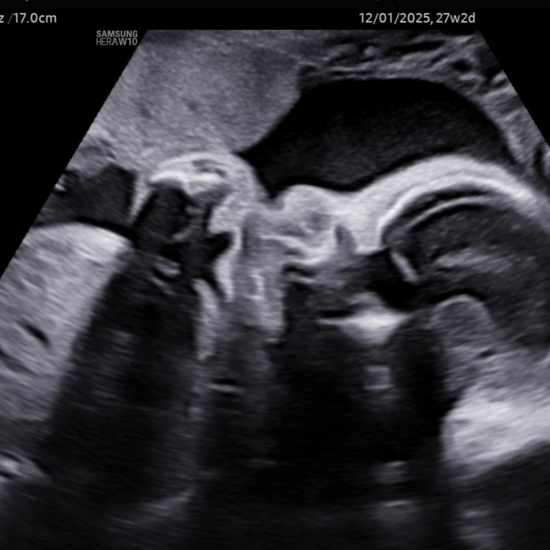 Photo shared by Angela for their Babylist baby registry.