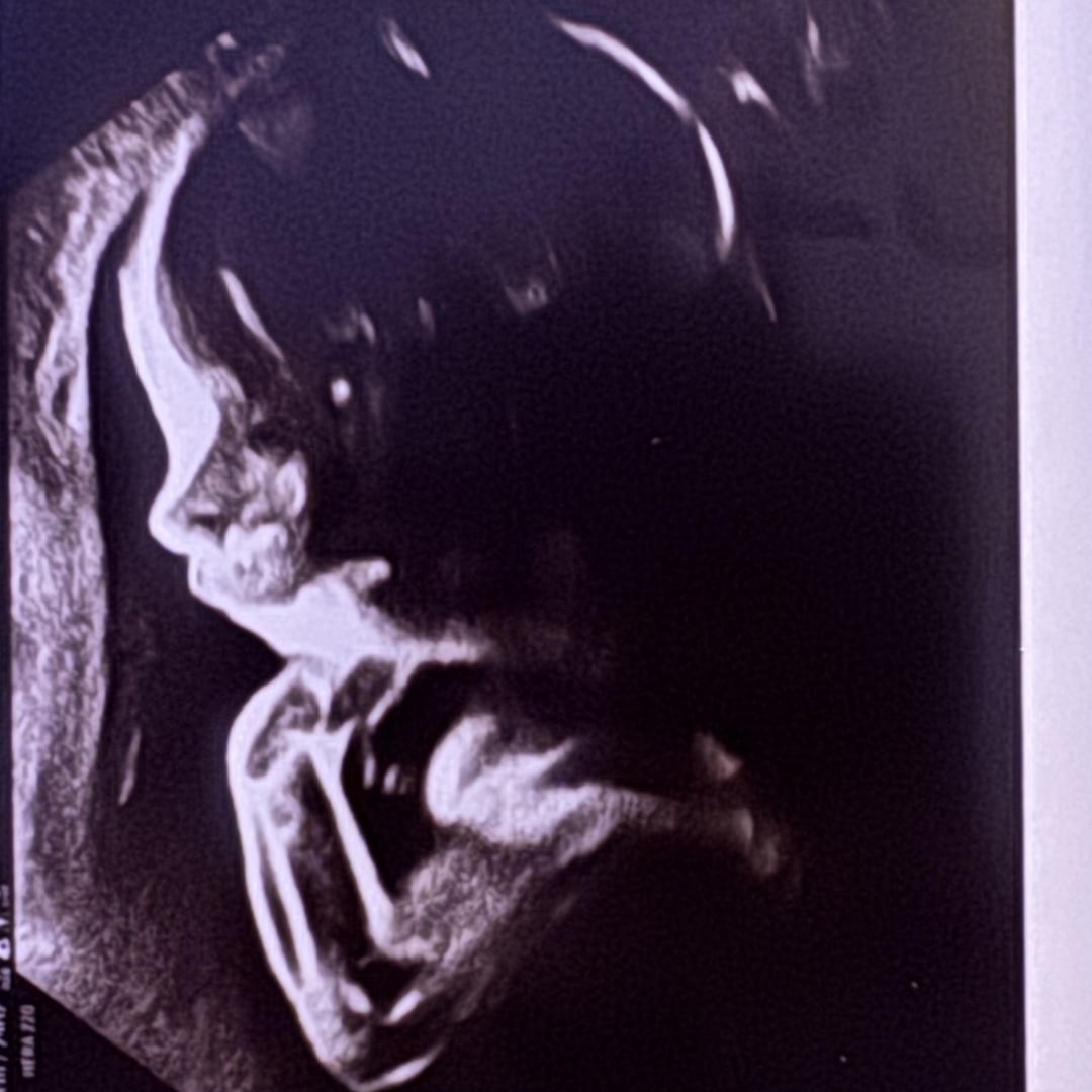 Photo shared by Vanessa for their Babylist baby registry.