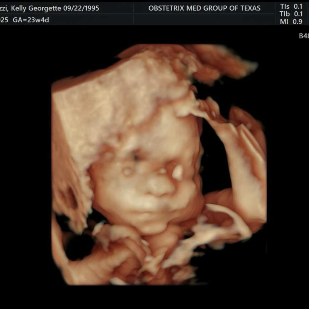 Photo shared by Kelly for their Babylist baby registry.