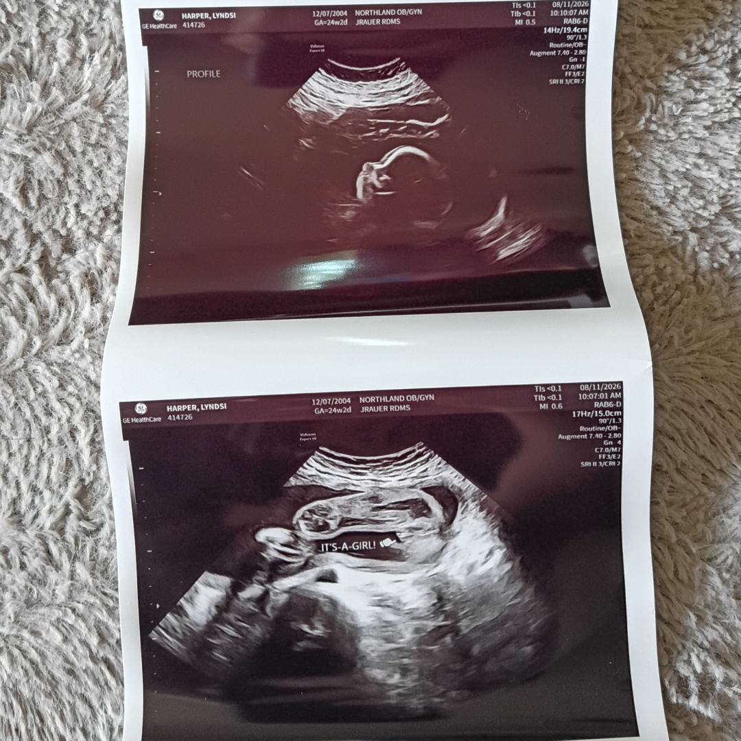 Photo shared by Lyndsi for their Babylist baby registry.