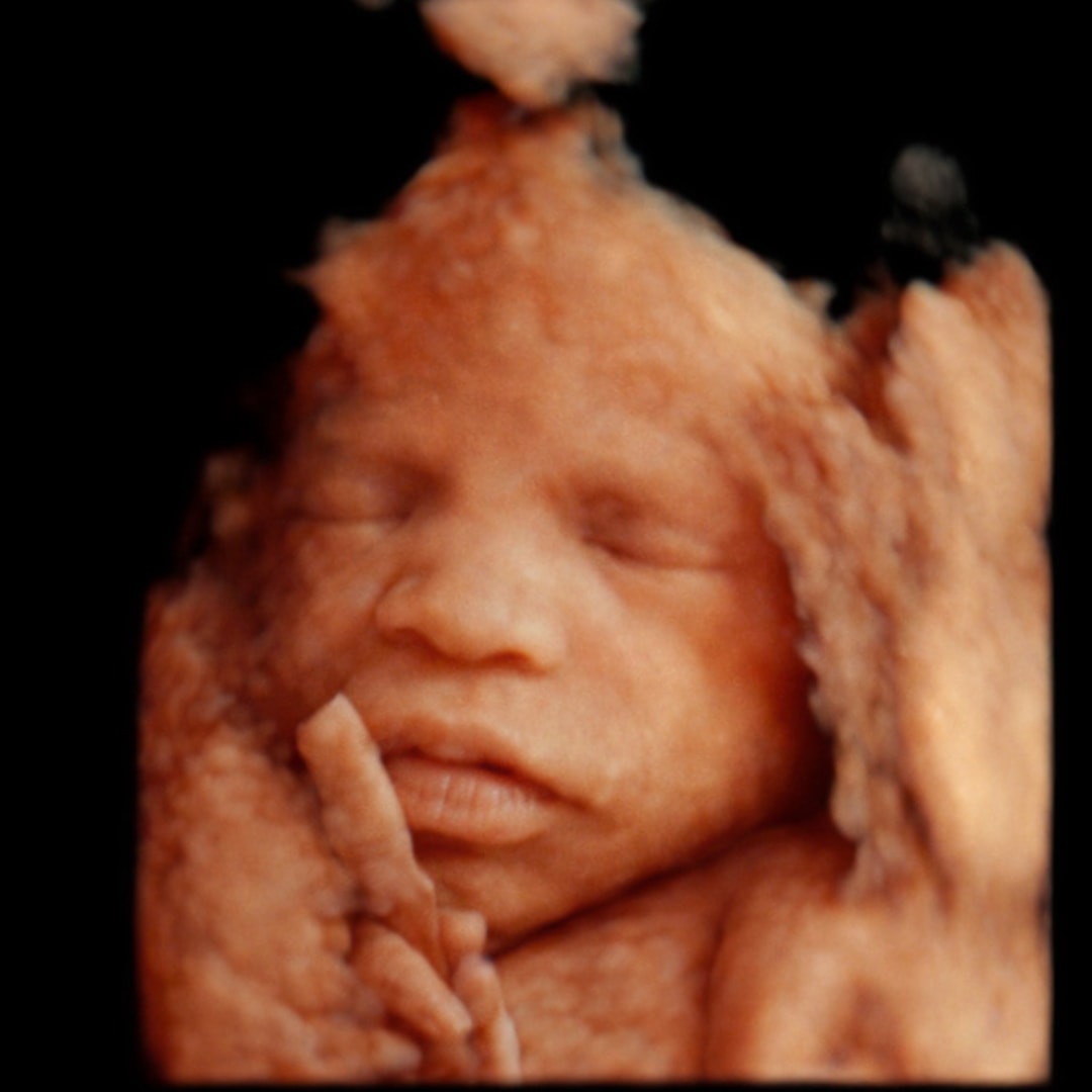 Photo shared by Treazure for their Babylist baby registry.