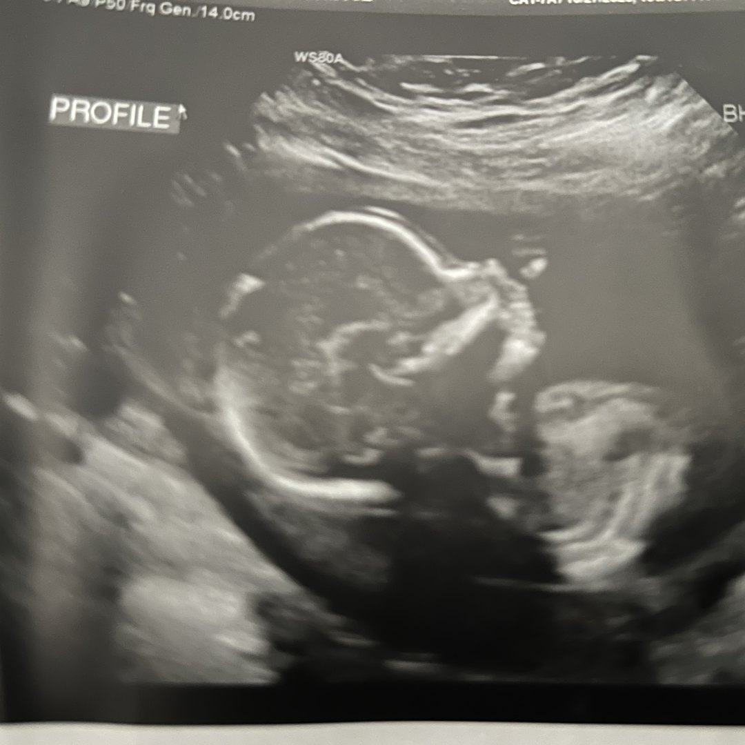 Photo shared by Erin for their Babylist baby registry.
