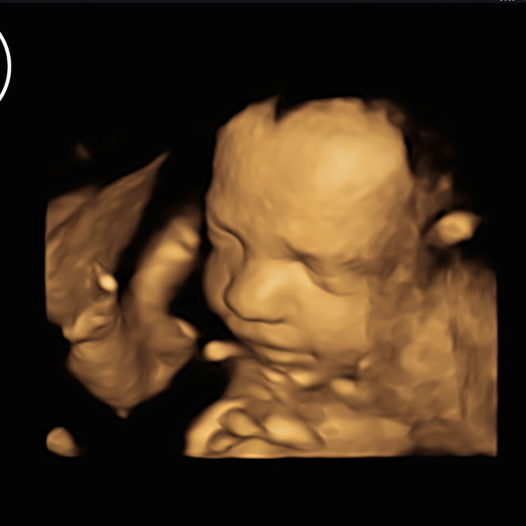 Photo shared by Janell for their Babylist baby registry.