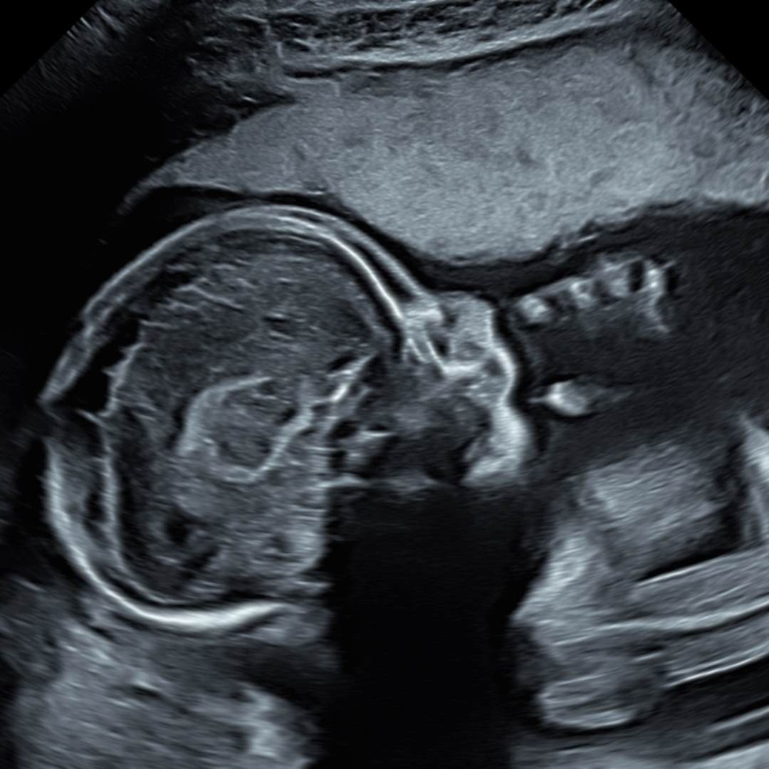 Photo shared by Jennifer for their Babylist baby registry.