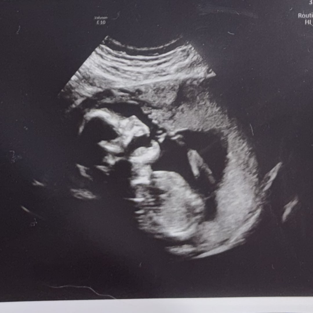 Photo shared by Brenna for their Babylist baby registry.