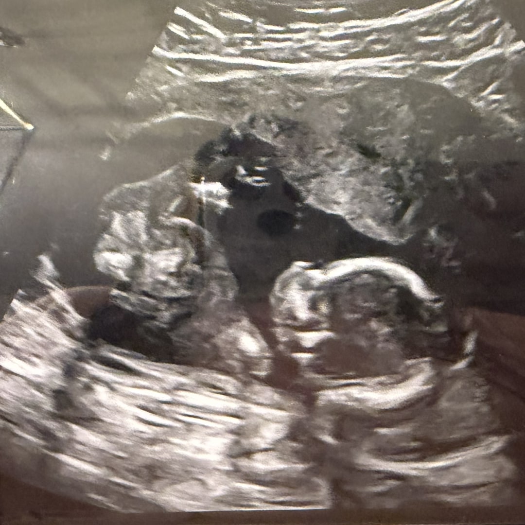 Photo shared by Stephanie for their Babylist baby registry.