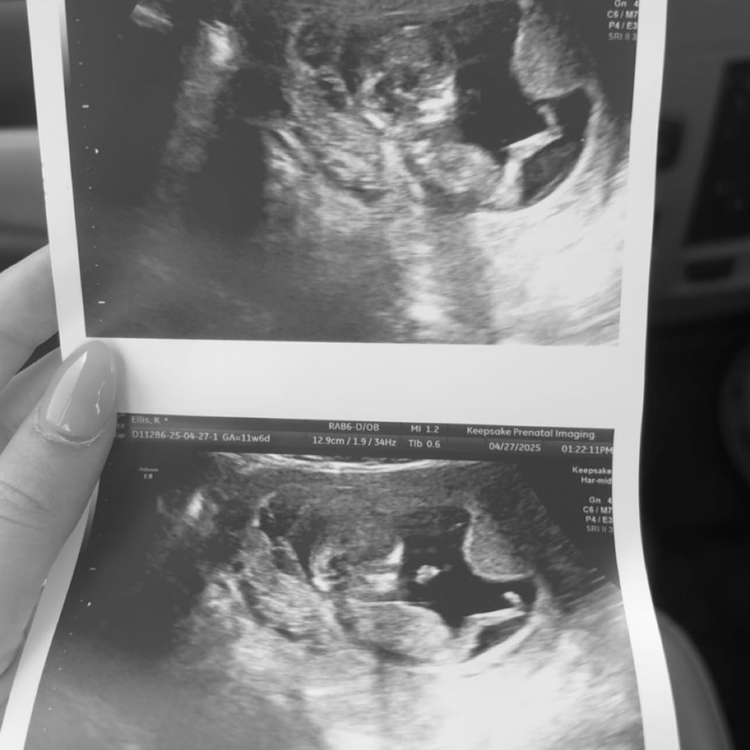 Photo shared by Katlyne for their Babylist baby registry.