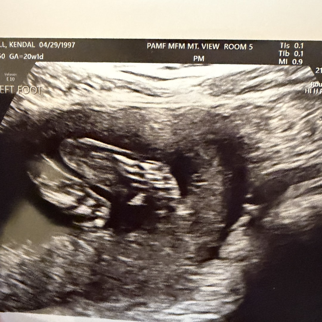 Photo shared by Kendal for their Babylist baby registry.