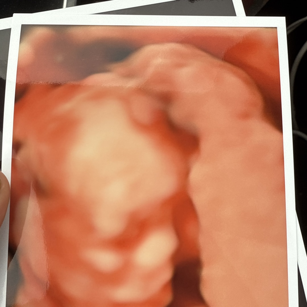 Photo shared by Summer for their Babylist baby registry.