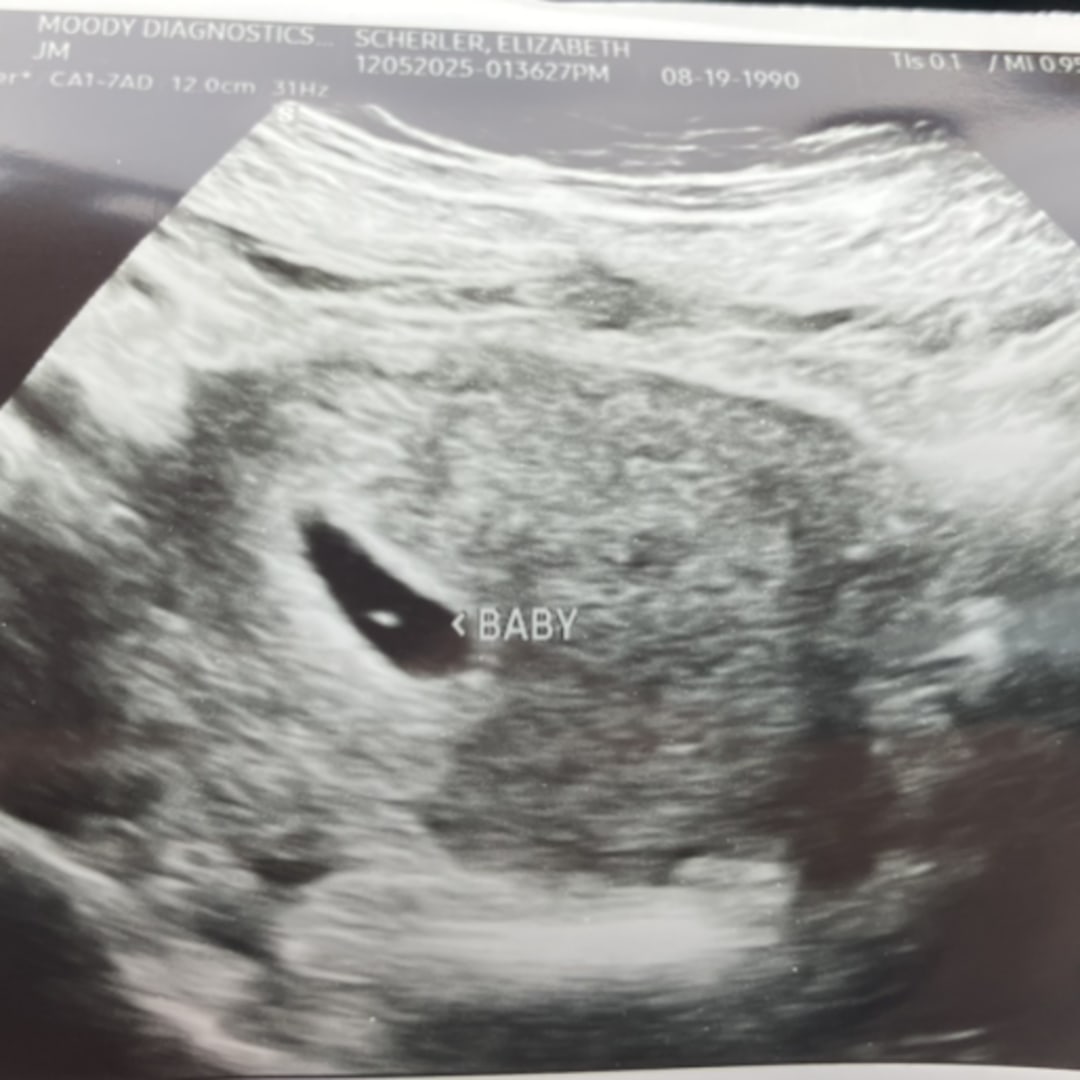 Photo shared by Elizabeth for their Babylist baby registry.