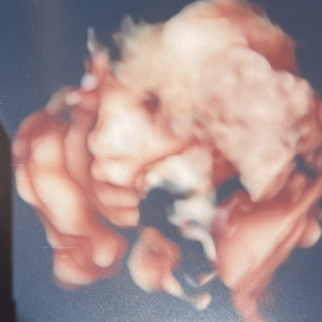 Photo shared by Jai for their Babylist baby registry.