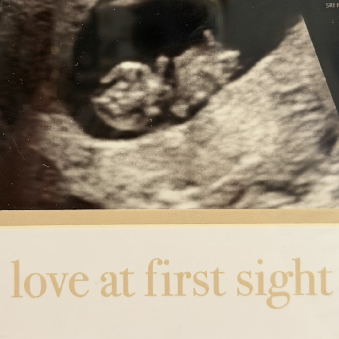 Photo shared by Allison for their Babylist baby registry.