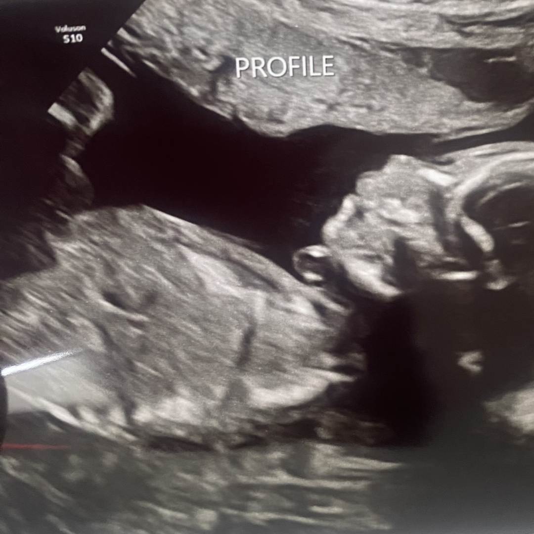 Photo shared by Katherine for their Babylist baby registry.
