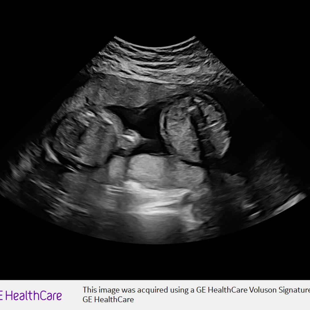 Photo shared by Paige for their Babylist baby registry.