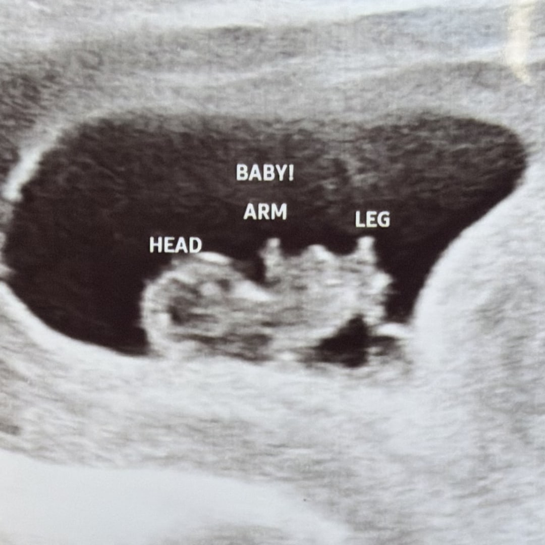 Photo shared by Daphne for their Babylist baby registry.