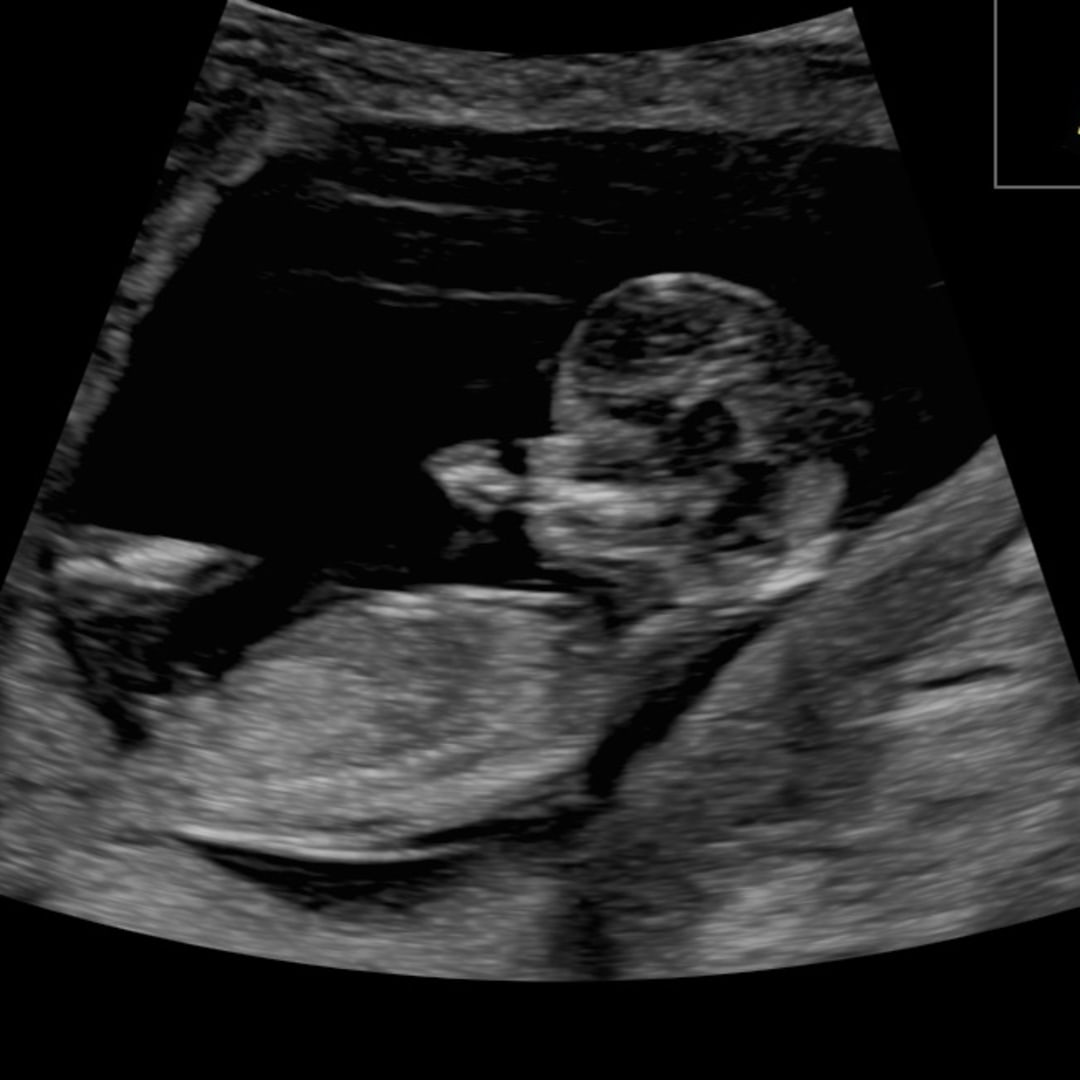 Photo shared by Abigail for their Babylist baby registry.