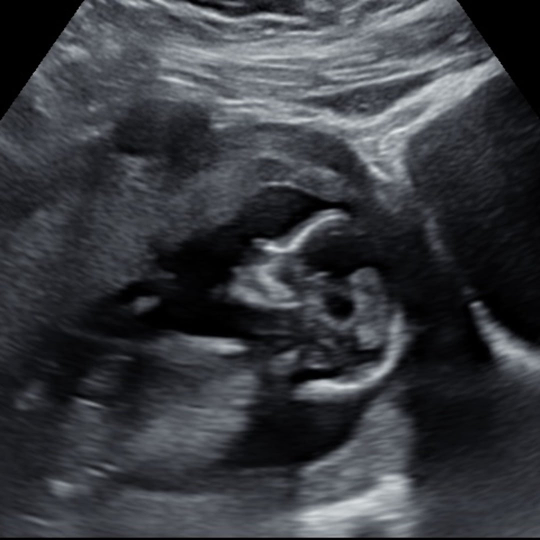 Photo shared by Madison for their Babylist baby registry.