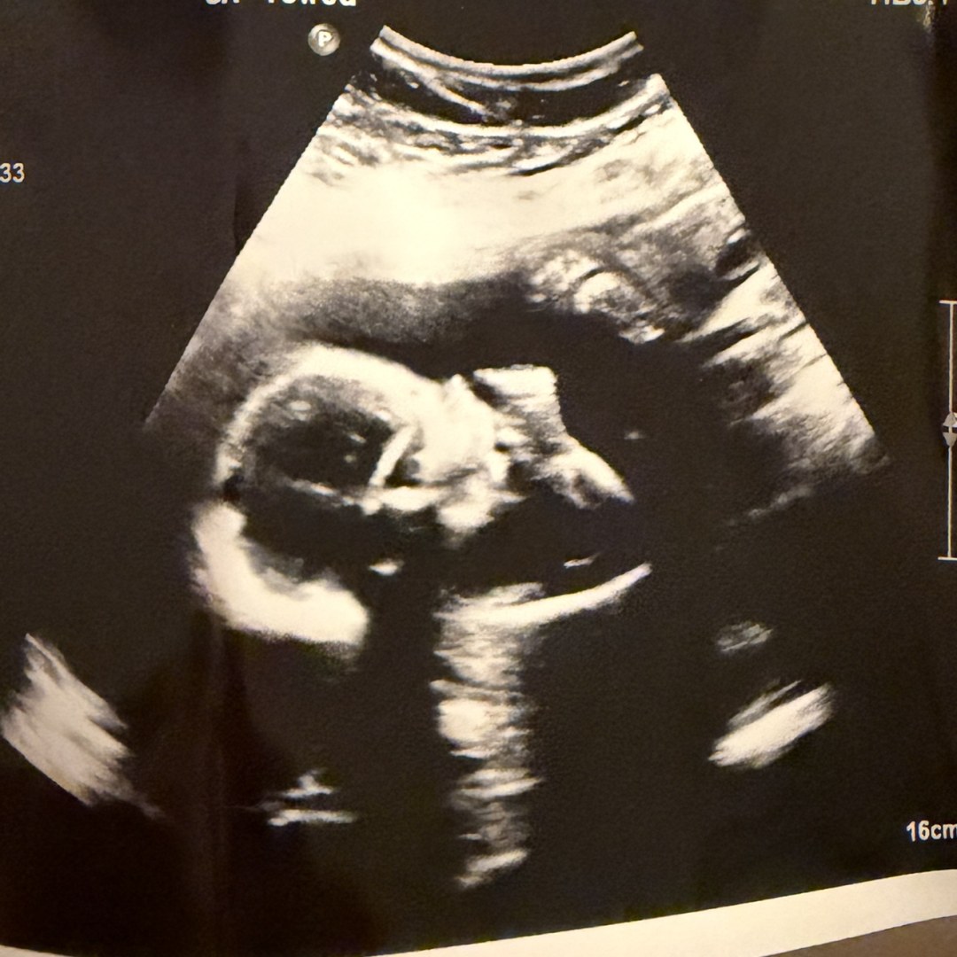 Photo shared by Emily for their Babylist baby registry.