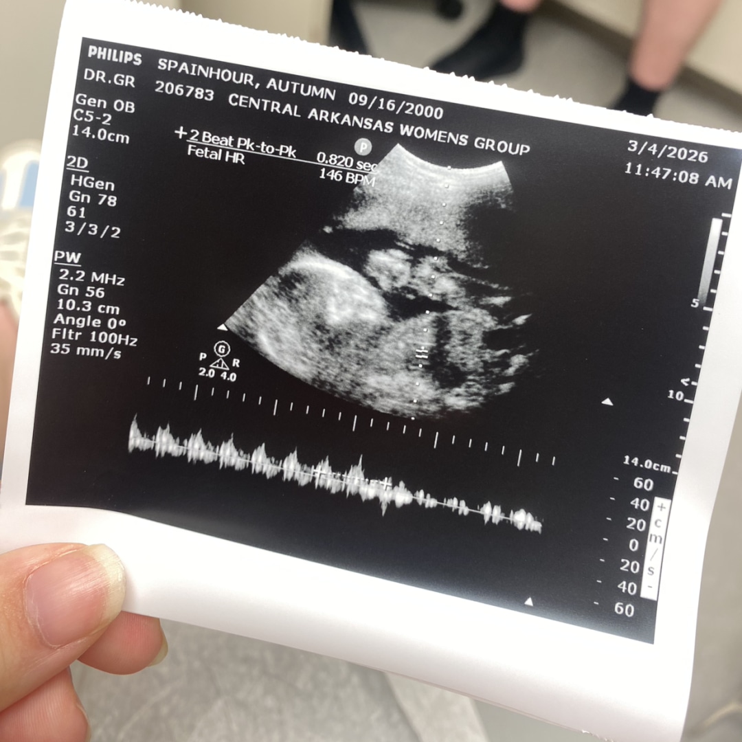 Photo shared by Autumn for their Babylist baby registry.