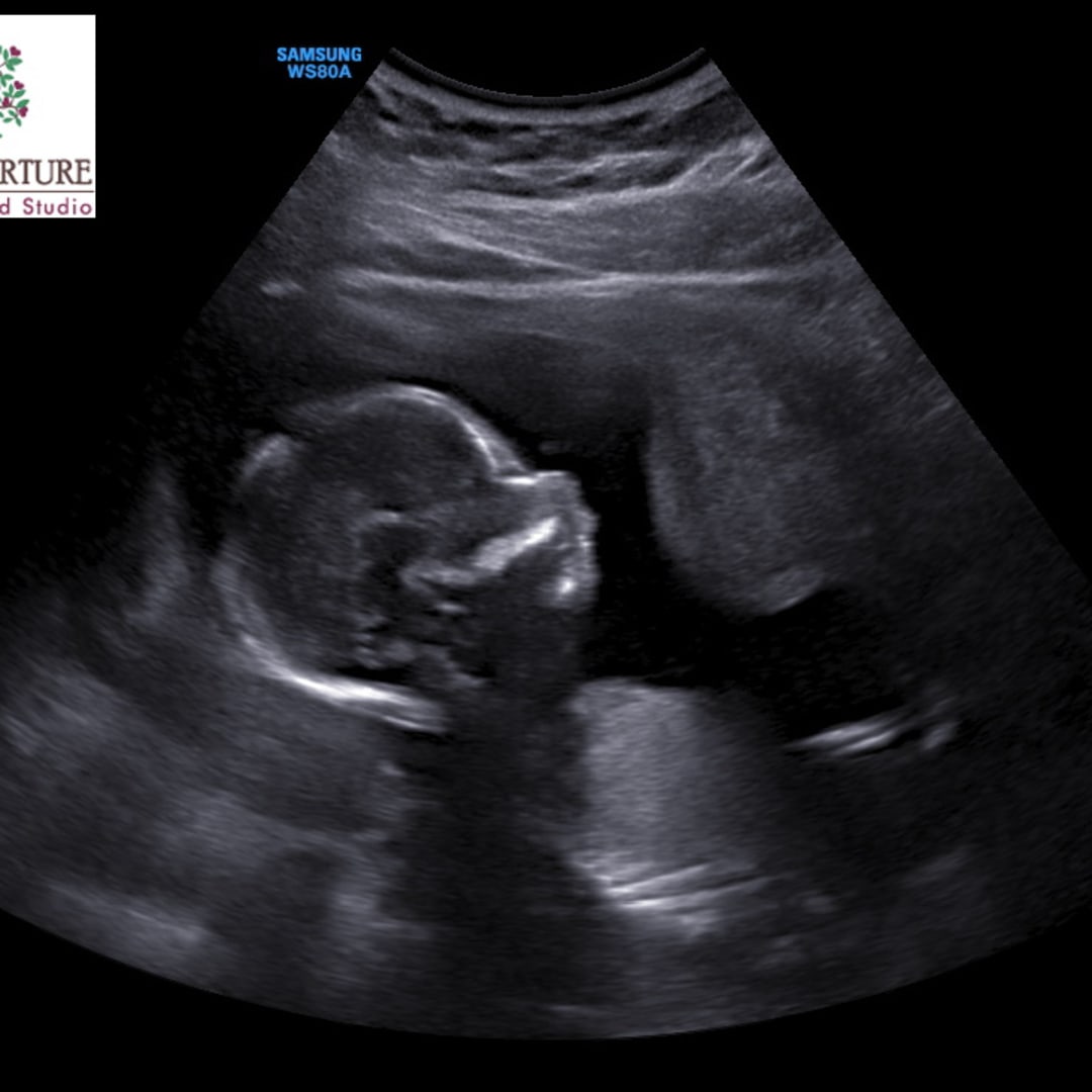 Photo shared by Kinsey for their Babylist baby registry.