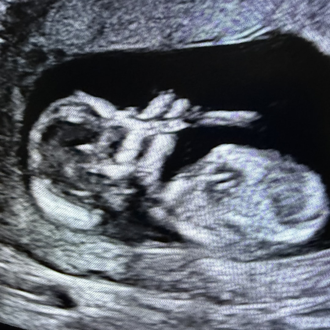 Photo shared by Lauren for their Babylist baby registry.