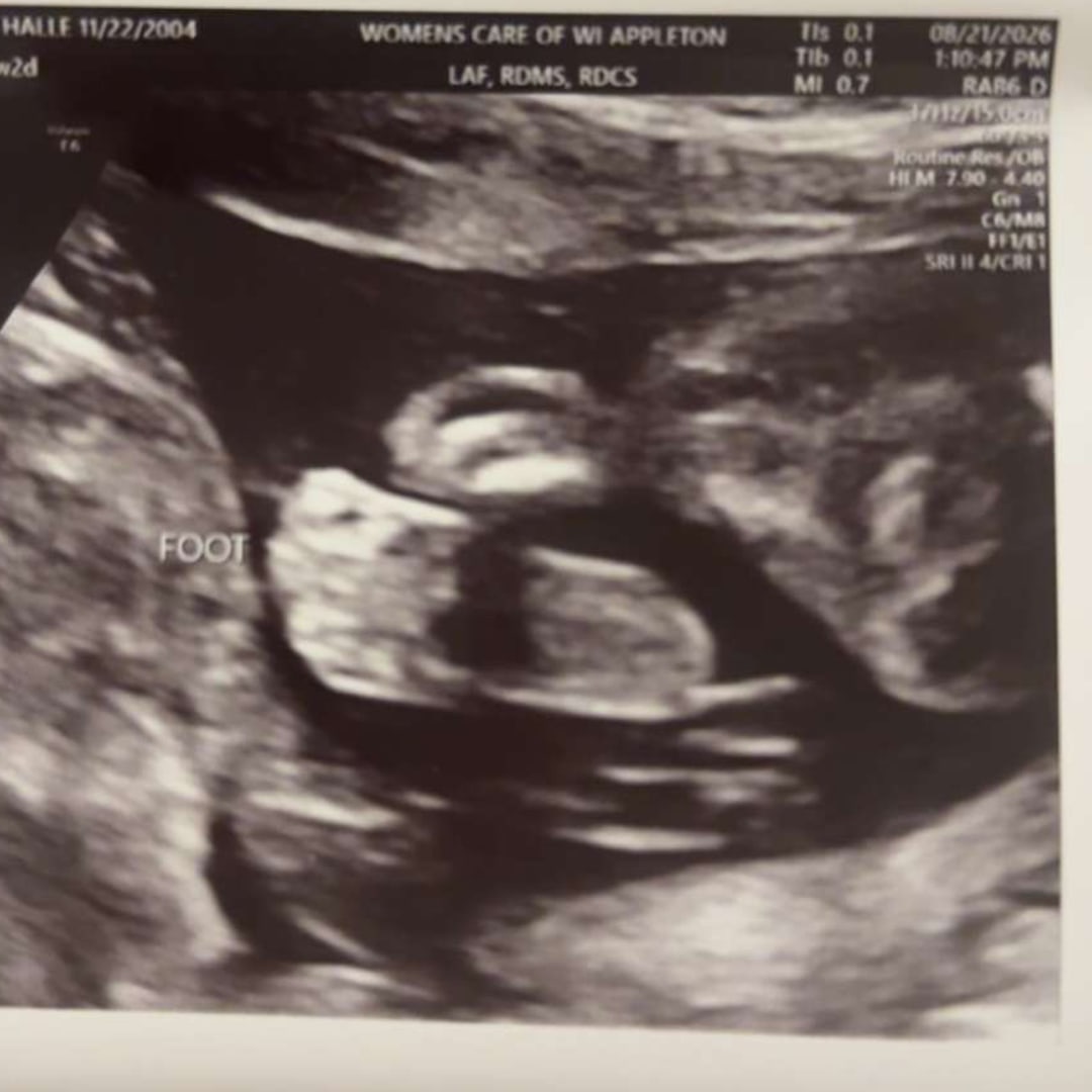 Photo shared by Morgan for their Babylist baby registry.