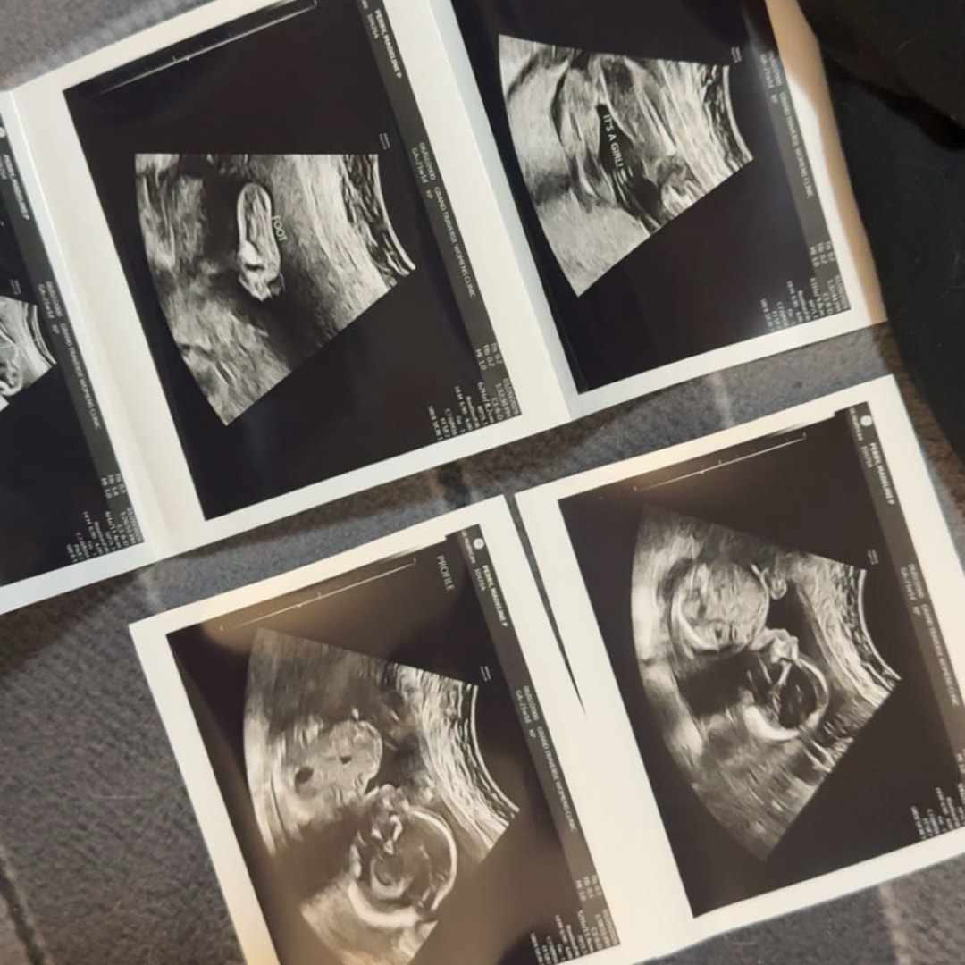 Photo shared by Maddy for their Babylist baby registry.