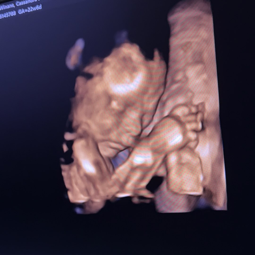 Photo shared by Cassie for their Babylist baby registry.