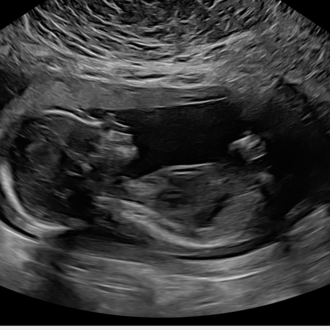 Photo shared by Tania for their Babylist baby registry.
