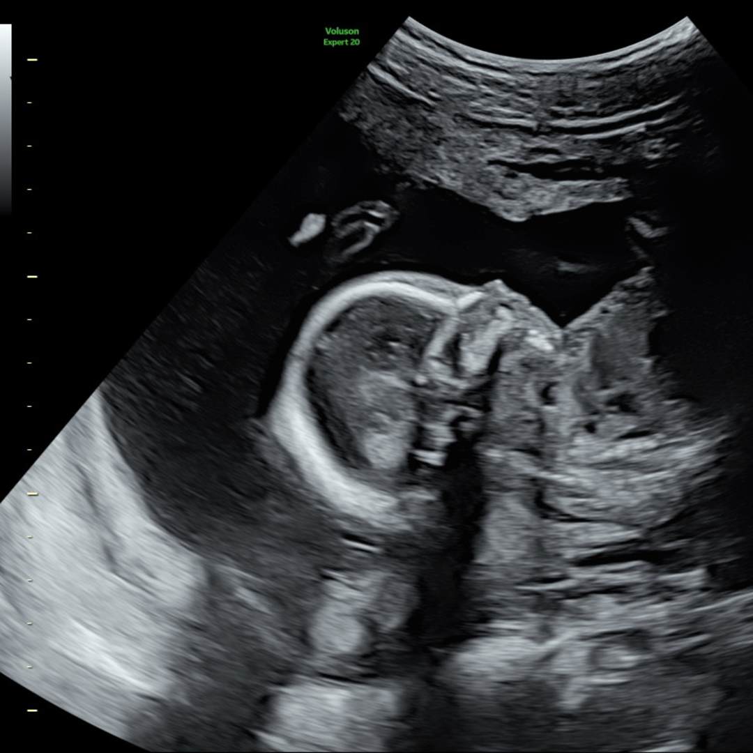 Photo shared by Kelcie for their Babylist baby registry.
