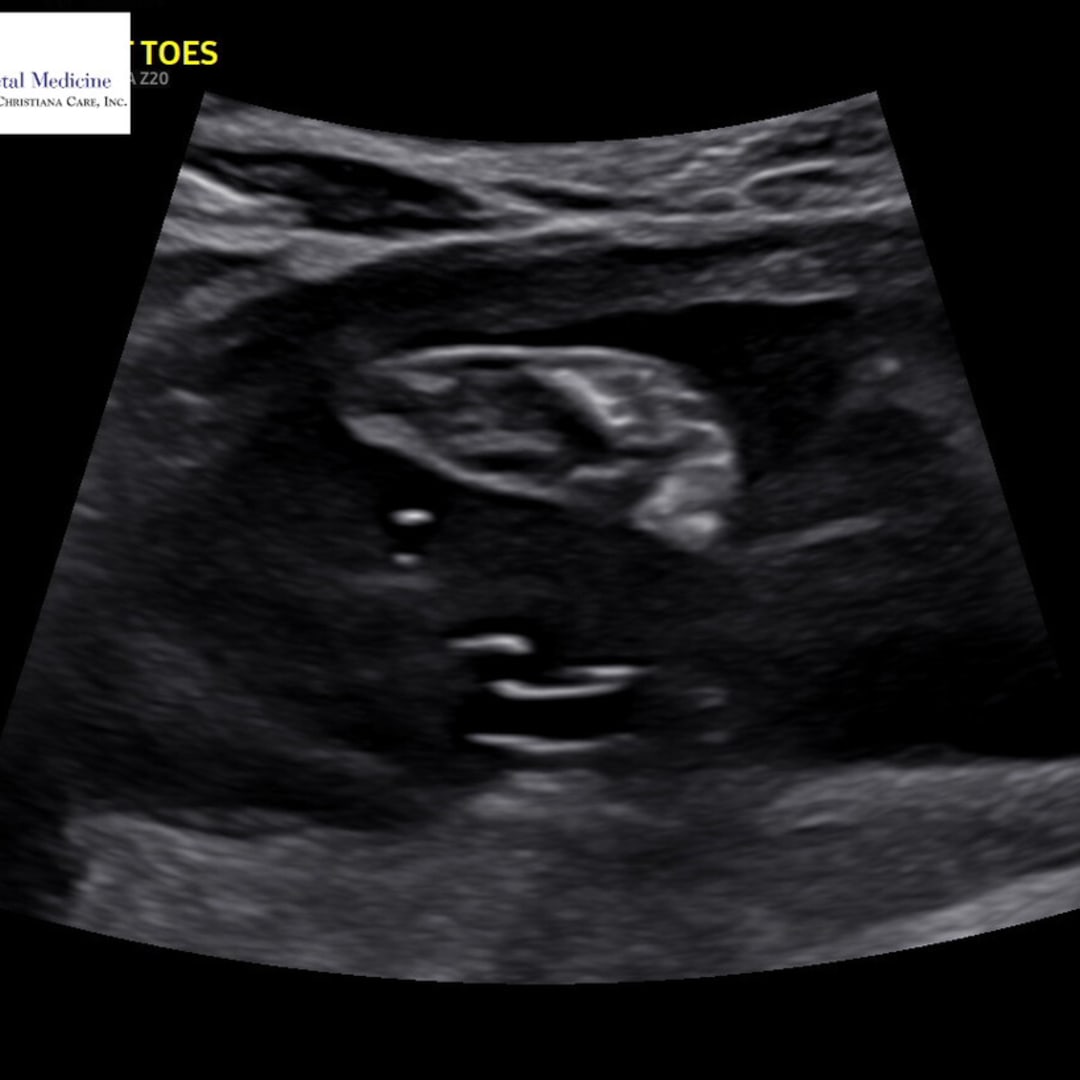 Photo shared by Ky for their Babylist baby registry.