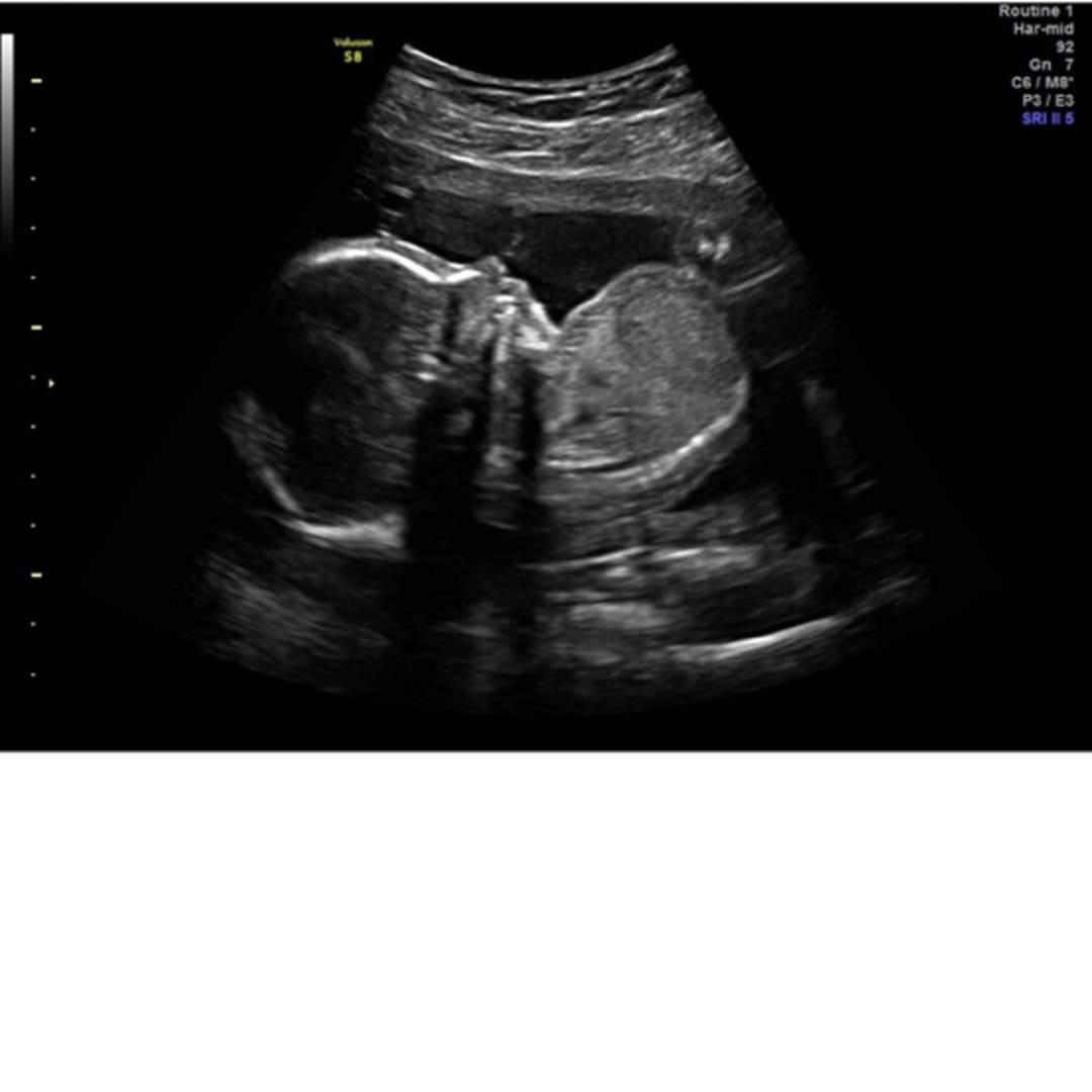 Photo shared by Emily for their Babylist baby registry.