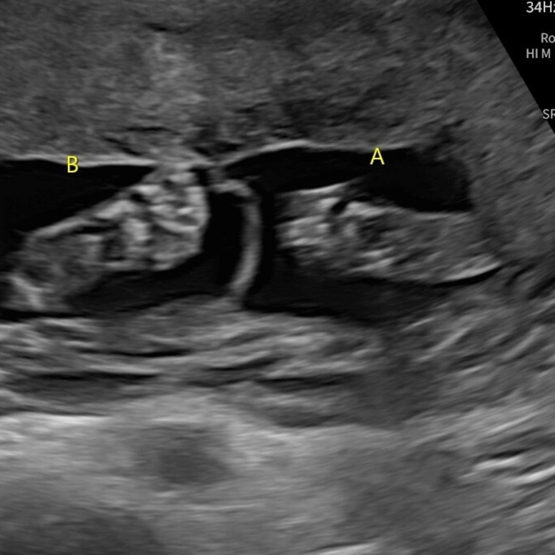 Photo shared by Kyrie for their Babylist baby registry.