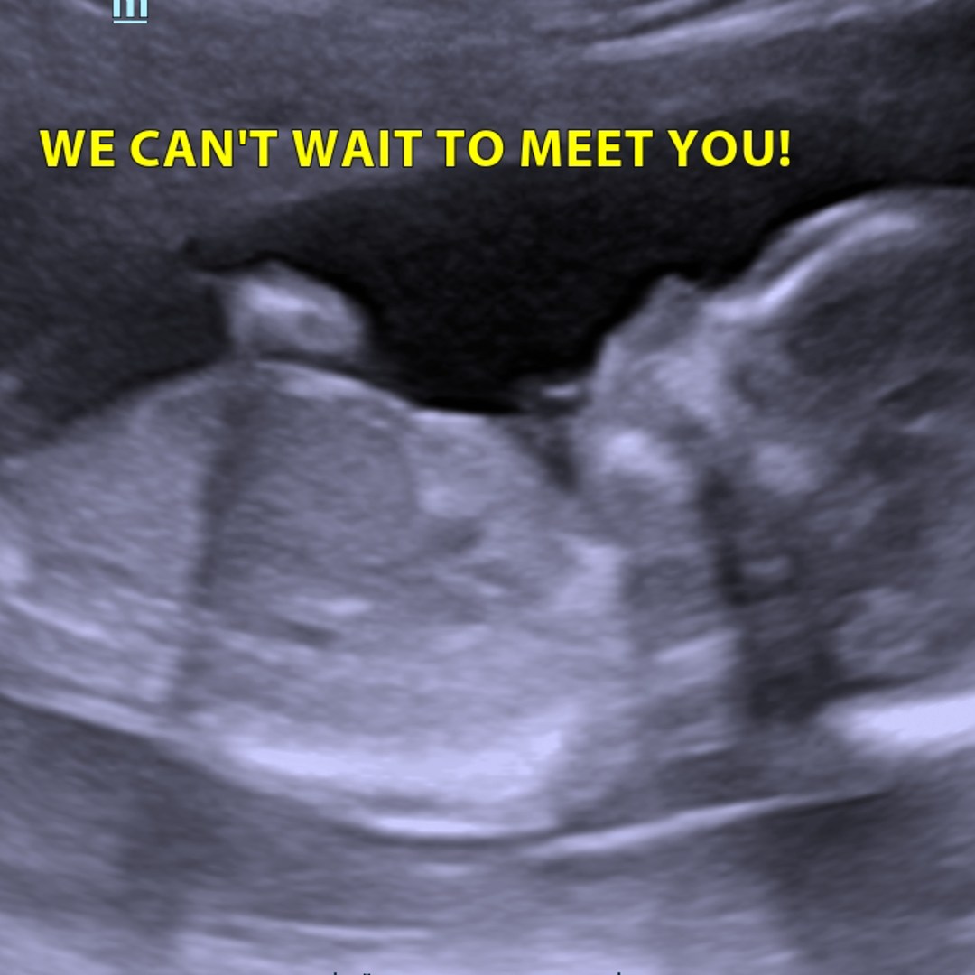 Photo shared by Giselle M for their Babylist baby registry.