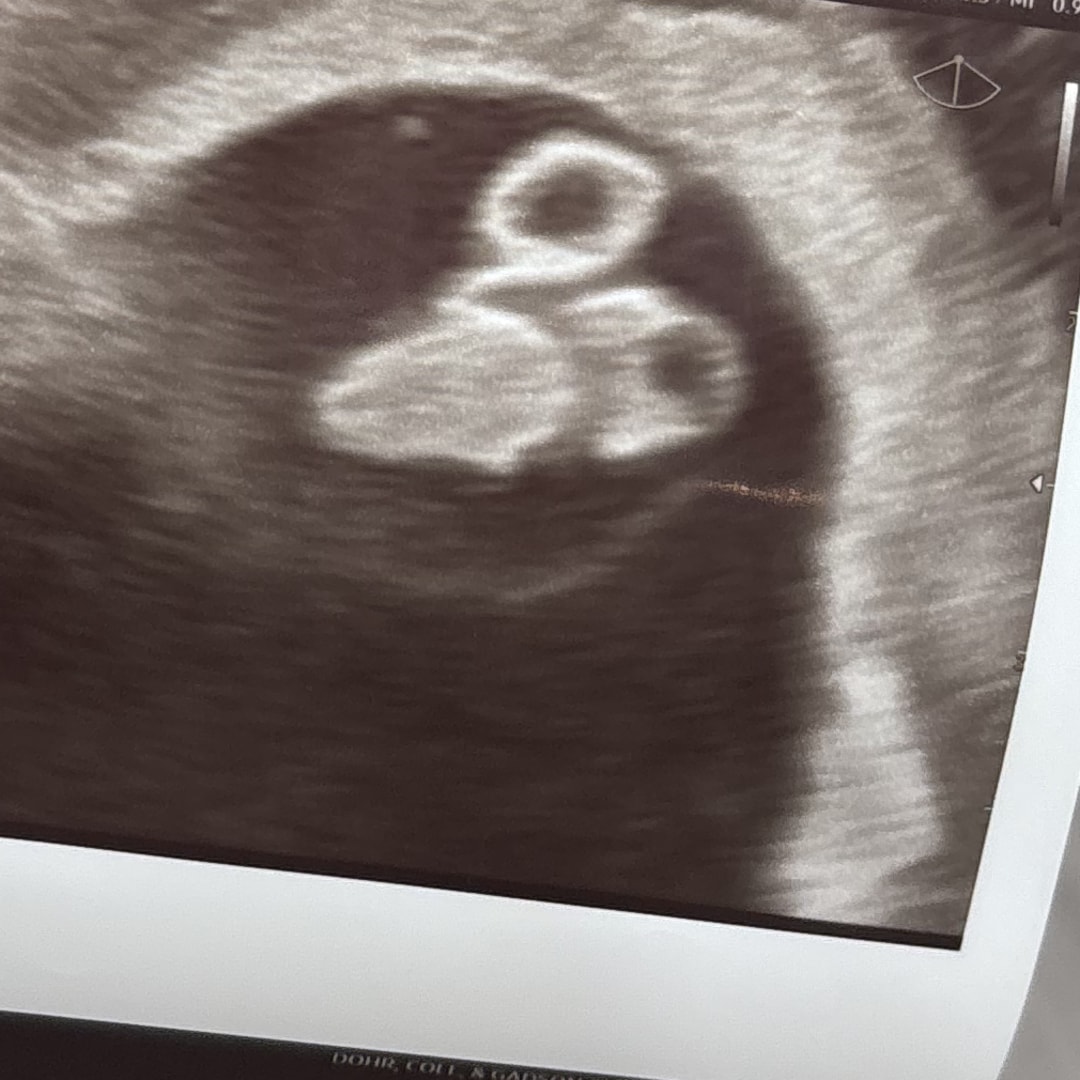 Photo shared by Zoe for their Babylist baby registry.