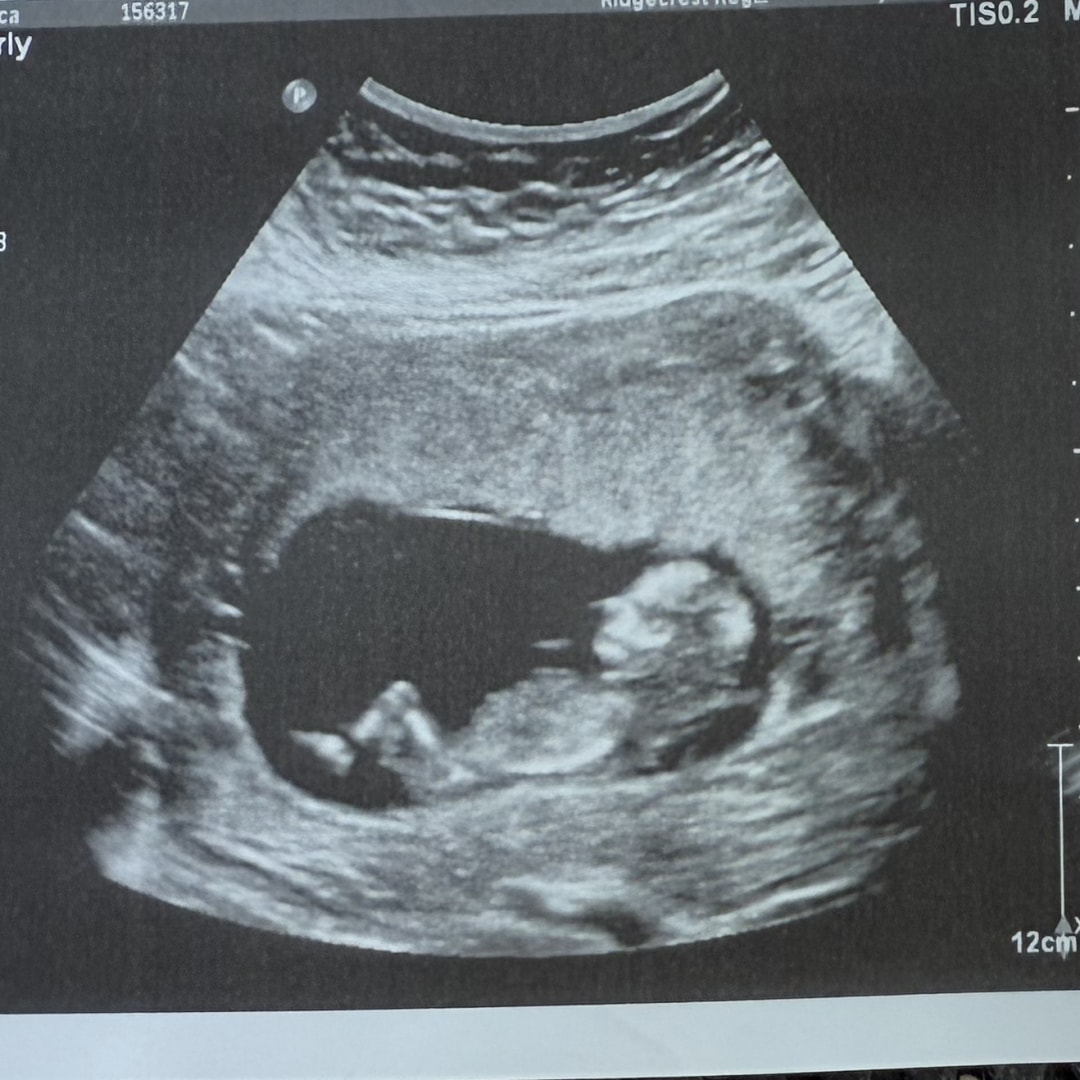 Photo shared by Jessica for their Babylist baby registry.