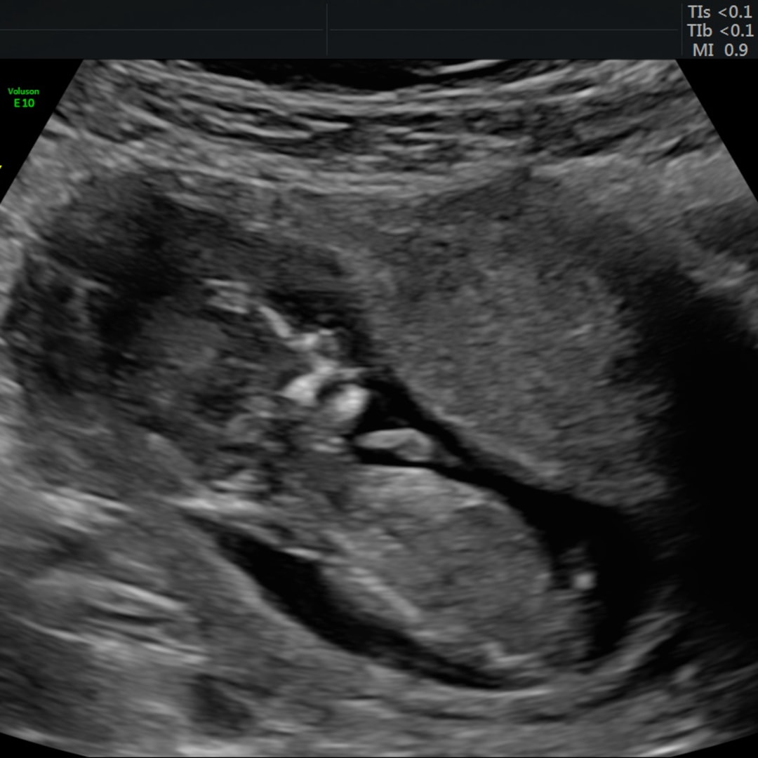 Photo shared by Alyssa for their Babylist baby registry.