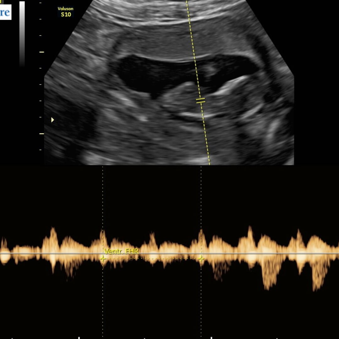 Photo shared by Kayla for their Babylist baby registry.