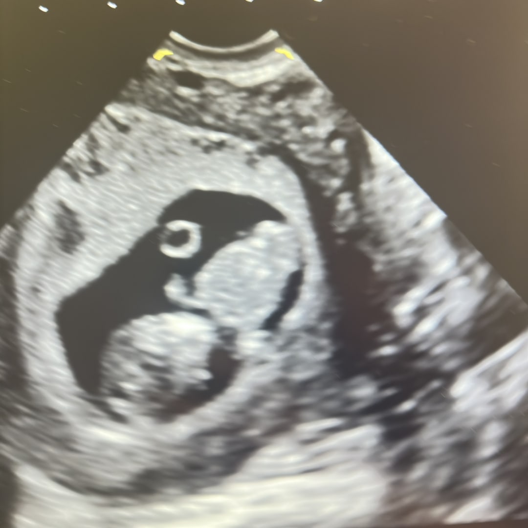 Photo shared by Baylee for their Babylist baby registry.