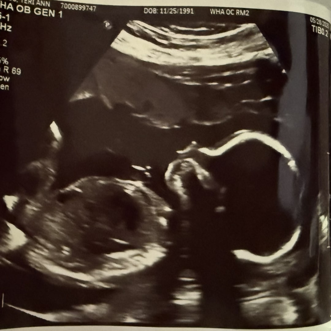 Photo shared by Teri for their Babylist baby registry.